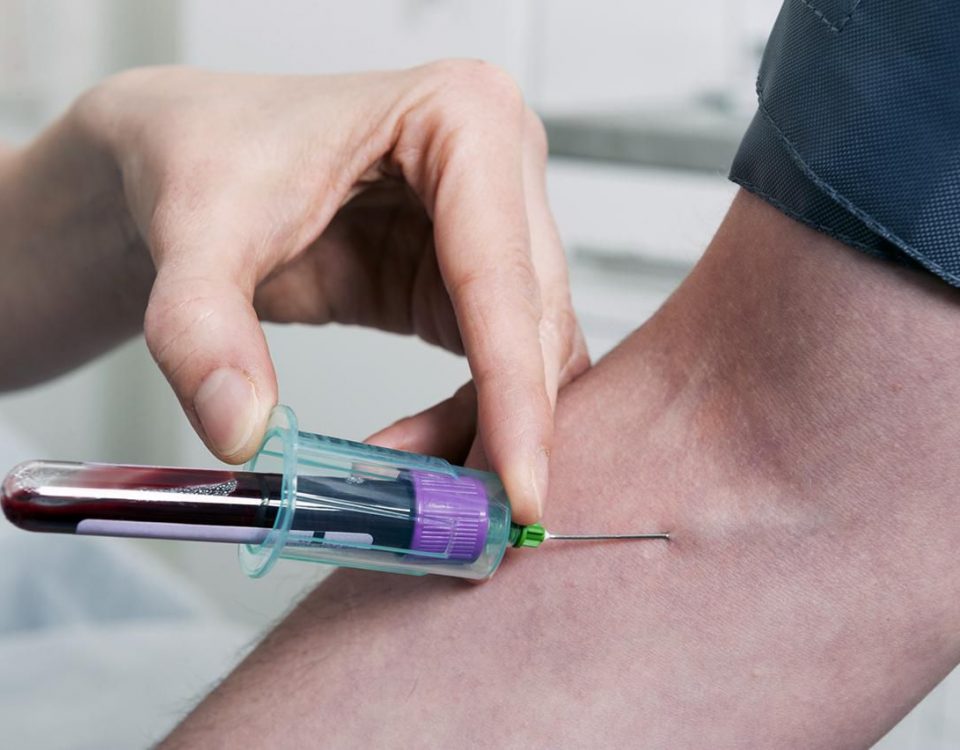Testing For Genital Herpes