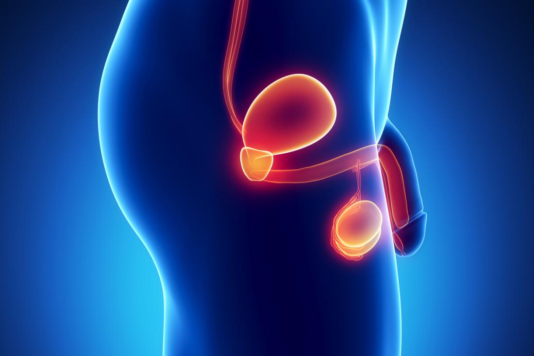 Some misconceptions about vasectomy