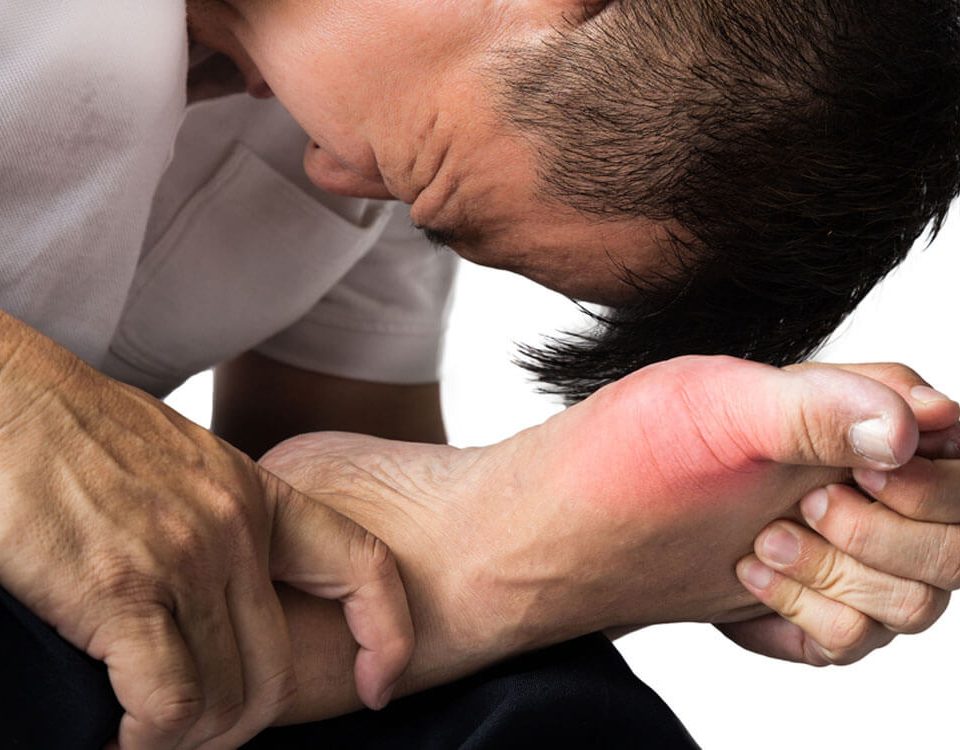 Gout can affect your sexual health and performance