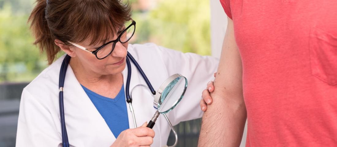 About Lichen Sclerosus