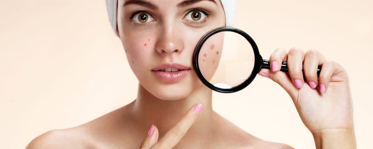 Acne Medication and Sexuality