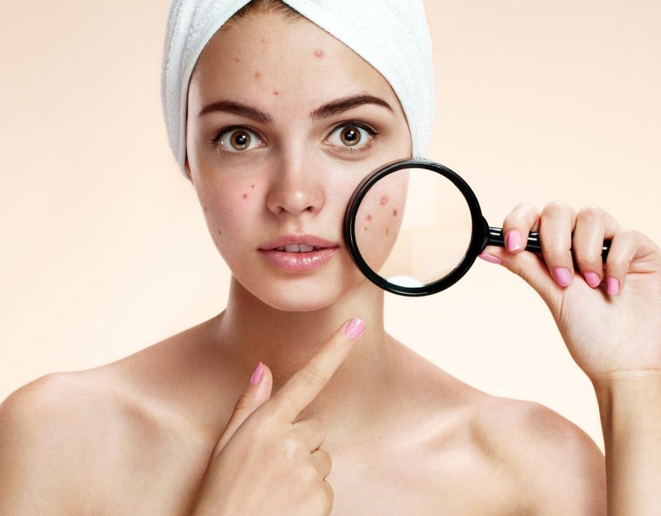 Acne Medication and Sexuality